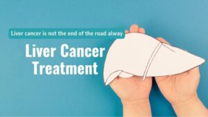 Liver cancer is not the end of the road always – Liver cancer Treatment